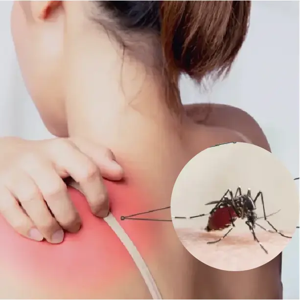 โรคที่เกิดขึ้นจากยุง